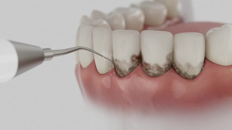 Reliable Dental Implants contractor in Larned, KS by Smile Center Dentistry